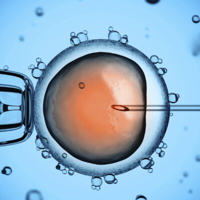 Why IVF could be the choice for you